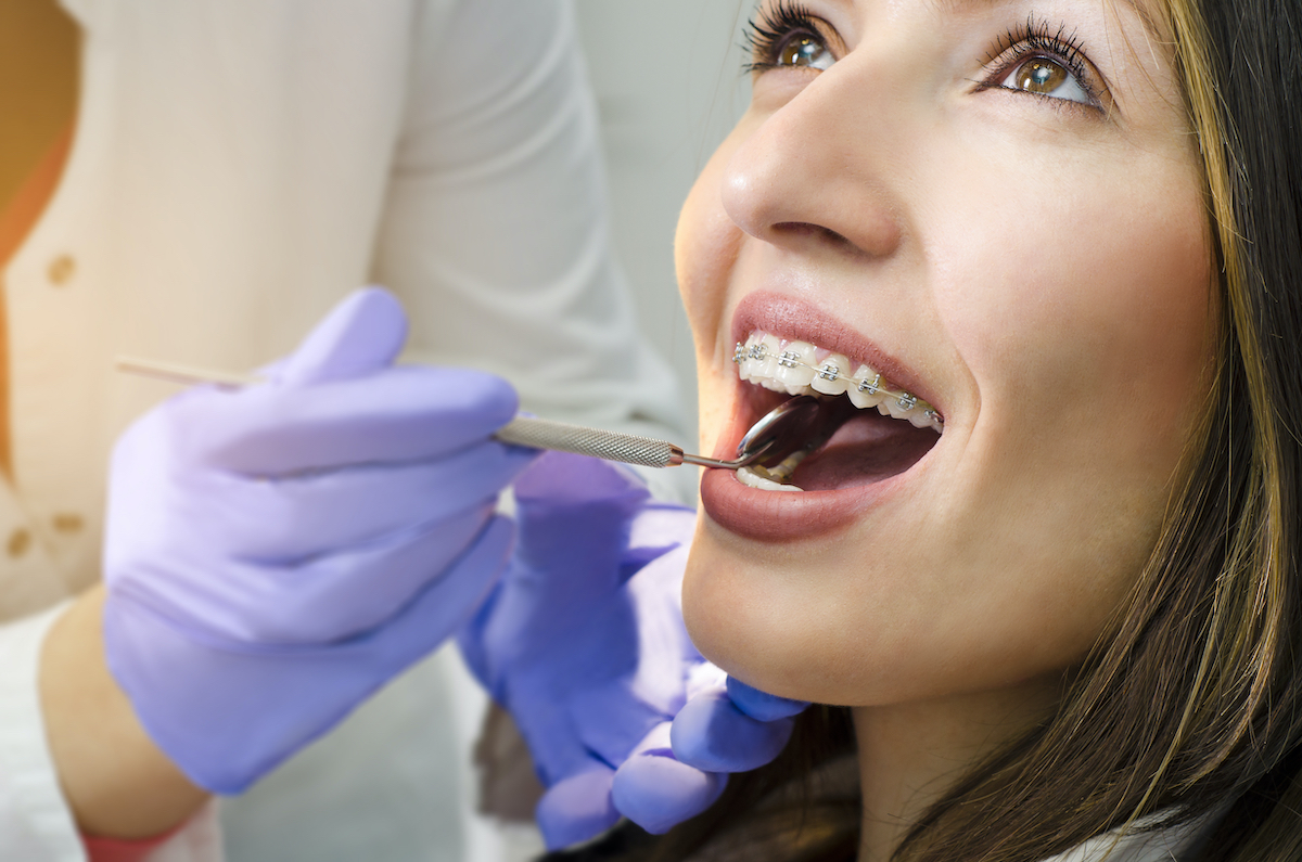 Compassionate orthodontist checking patient's dental braces