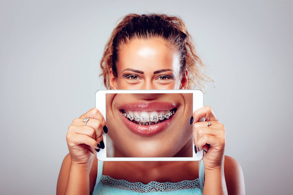 dental braces patient showing her smile on an ipad mobile application for orthodontists