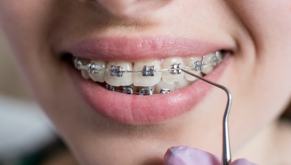 Dental braces patient visiting orthodontic office