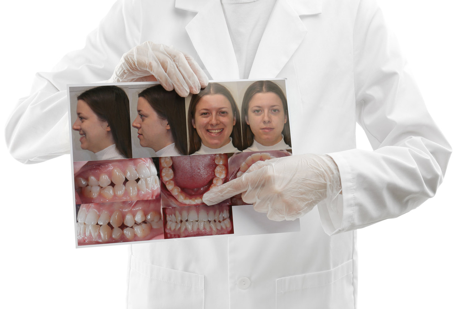 dentist holding photo of patient and patient teeth as record