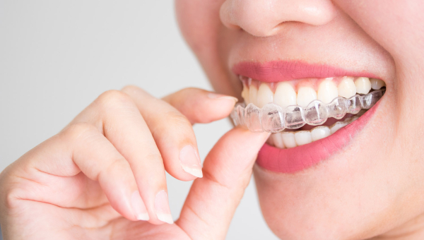 patient holding clear aligners